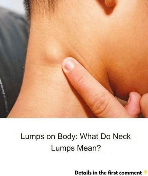 When to worry about neck lumps and what to do about them.