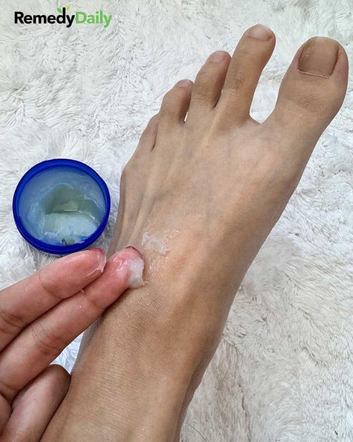 Lady rubs Vicks Vaporub on her feet before she sleeps for this brilliant reason