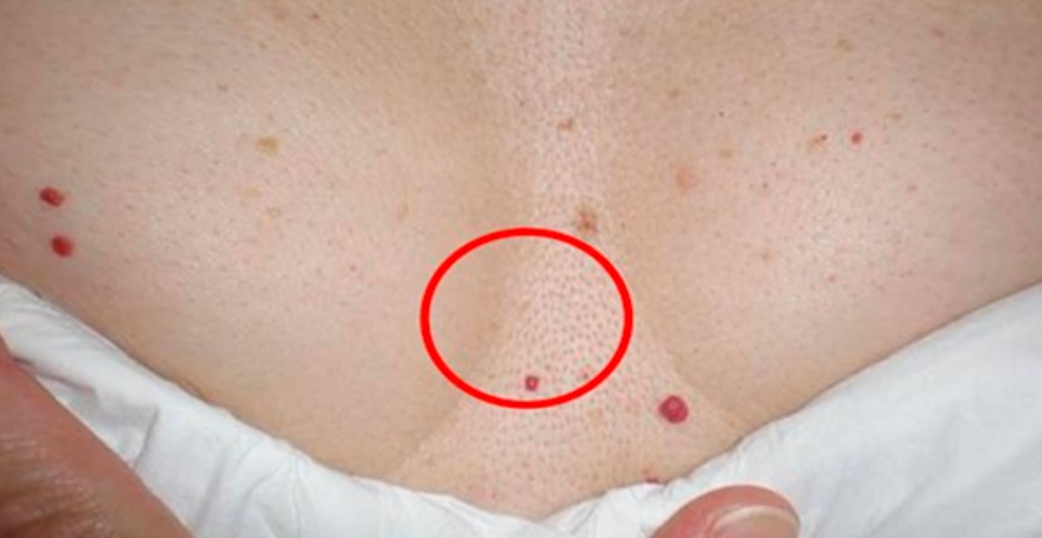 What to do if you have red spots on different parts of your body and if they should bother you?