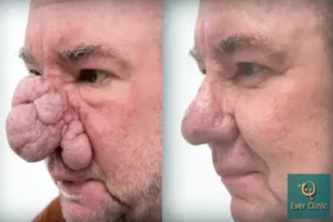 Alan Findlay’s journey to a facial transformation that will change his life is described in “A New Beginning.”