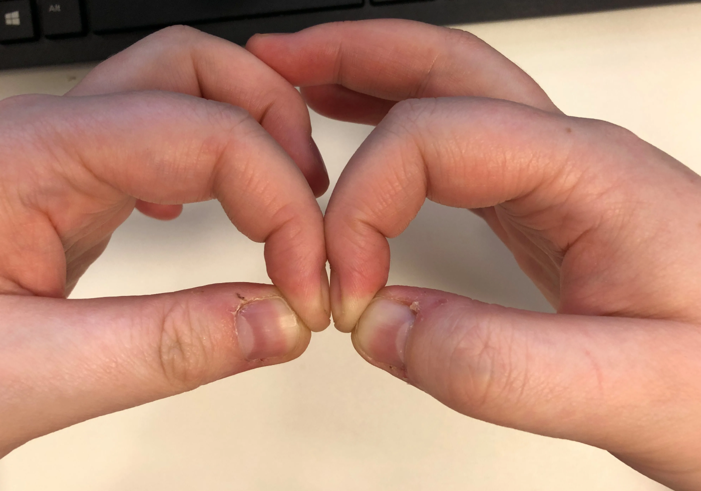 The Power of Your Fingernails: A Simple Test for Early Cancer Detection